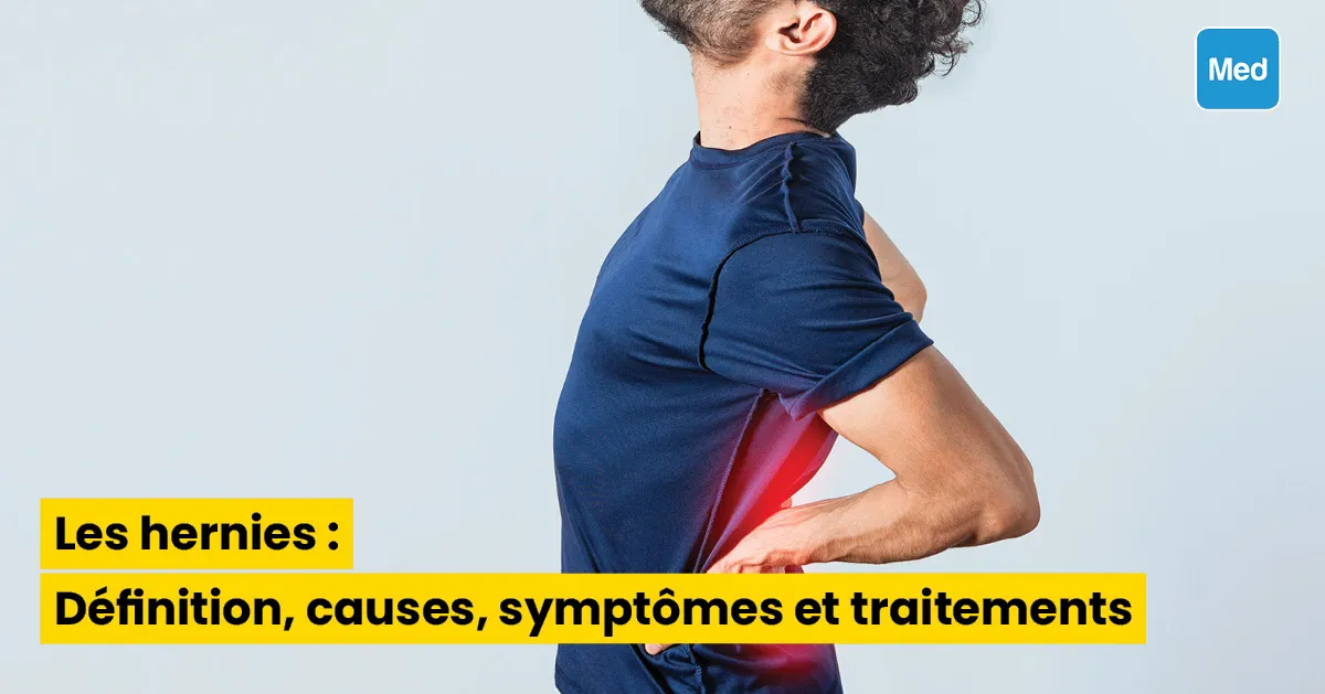 Les hernies : Définition, causes, symptômes et traitements